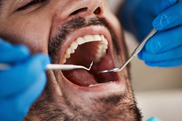 Best Tooth Infection Emergency Dentist  in Leesburg, OH