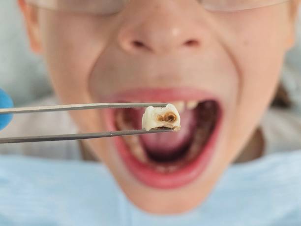 Best Tooth Pain Emergency Relief  in Leesburg, OH
