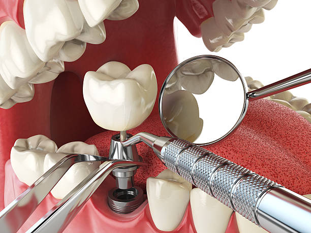 Best Emergency Gum Pain Relief  in Leesburg, OH